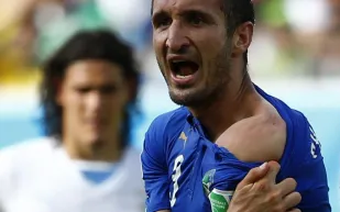 عضة سواريز لكيليني عبارة عن صورة فوتوشوب !!