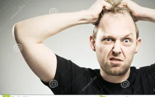 كيف تعرف إذا كنت ستصاب بالصلع أم لا؟