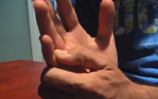 فيديو...سعودي يكسر إصبع صديقه ليأخذ إجازة في العيد من العسكرية