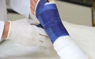 الرجال أقل اهتماما من النساء في متابعة فحوصات الكسور