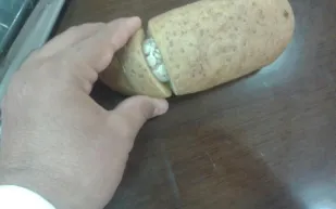 سعودي يعثر على 460 حبة كبتاجون داخل ثمرة بطاطس