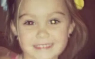 بالصورة: نشرت صورة ابنتها على "فيسبوك".. فاكتشفت أنها قد تصاب بالعمى