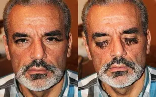 بالصور: صاحب أطول رموش في العالم