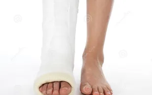 ضبط أغلى جبيرة ساق في مطار دبي