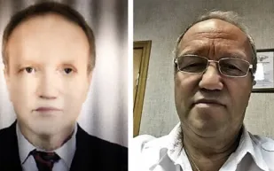 فاجأ الأطباء بتحوله الى اللون الأسود !!