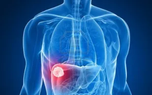 “القاتل الصامت”.. أرقام وحقائق