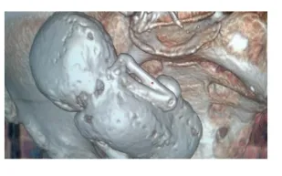 لن تصدق جزائرية عمرها 73 تحمل جنينا عمره 35 سنة