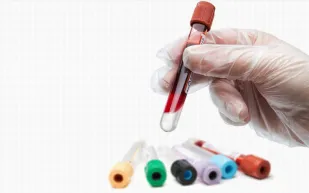 لائحة بأهم الفحوص الروتينية لصحة الرجل