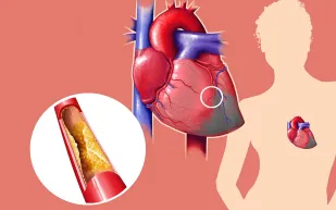أدوية خفض الكولستيرول ضرورة للاصحاء أيضا
