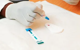 دولة آسيوية تسجل زيادة الإيدز بنسبة 140 في المئة