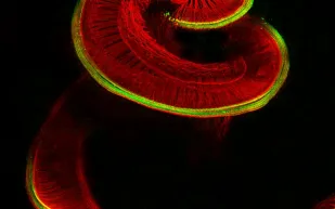 شاهد| أروع الصور المجهرية على الإطلاق