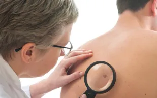 تعرف على مخاطر تناول الأسبرين يومياً