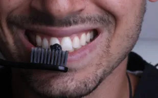 تبييض الأسنان بالفحم.. بين الحقيقة والخرافة