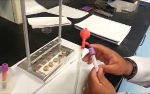 ما هي سرعة الترسيب وأسبابها وكيفية التخلص منها؟