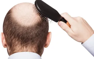 تعاني من مشاكل الشعر.. إليك أهم الفيتامينات الطبيعية لمظهر حيوي