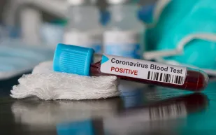 أكثر فصائل الدم عرضة للإصابة بكورونا 