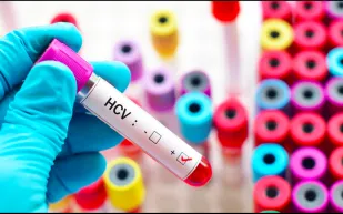 التهاب الكبد الوبائي.. الأعراض وطرق العلاج 