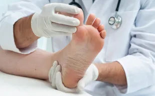 ما هو مسمار القدم.. وكيفية الوقاية والعلاج؟