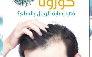  انفوجراف| هل هناك علاقة بين الصلع والإصابة بكورونا؟