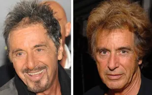 صور| نجوم هوليوود مشهورون بالشعر المستعار