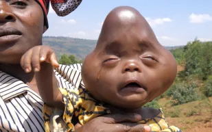 والده رغب في قتله ولقبه بالشيطان..قصة أغرب طفل في العالم (فيديو)