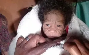 ولادة رضيعة بجسد عجوز في حالة نادرة بجنوب إفريقيا (صور)