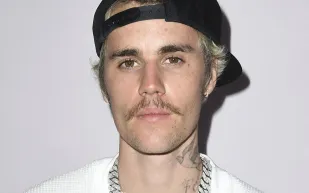 «جاستن بيبر» بوجه منتفخ وملامح صادمة بعد اكتسابه عشرات الكيلو غرامات! (فيديو)