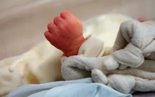 طفل يولد بذيل وكرة في نهايته والأطباء يفسرون الحالة (صور)