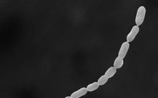 اكتشاف أكبر بكتيريا في العالم.. فهل تشكل خطرًا على البشر؟