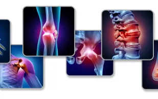 ماذا تعرف عن الروماتيزم؟ أعراضه وعلاجه وأهم طرق الوقاية