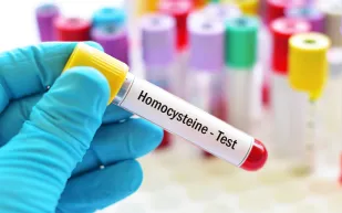 تحليل الهوموسيستين.. ما أهميته لصحة الرجل؟