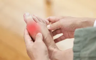 "ليس التهاب المفاصل فقط".. إليك أهم أعراض النقرس وطرق العلاج