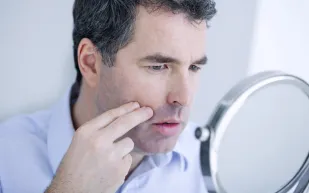 خبراء يحذرون من أجهزة تسمير البشرة: قد تسبب سرطان الجلد