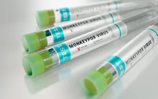 "جدري القرود".. هل يكون الوباء العالمي القادم؟