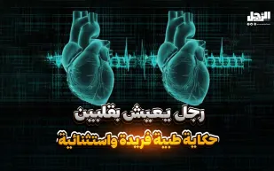 رجل يعيش بقلبين حكاية طبية فريدة واستثنائية! (فيديوجراف)