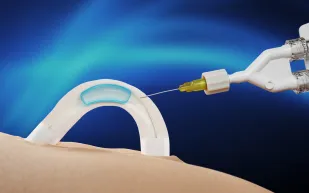 وسيلة منع حمل جديدة للرجال تستمر عامين بدون جراحة