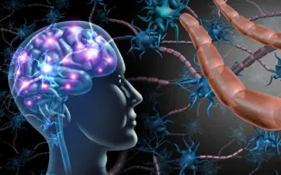 إنجاز طبي واعد في علاج أحد أنواع التصلب المتعدد