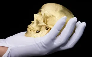 جمجمة ذهبية في مزاد.. الطبيب الذي حوّل رأسه إلى عمل فني