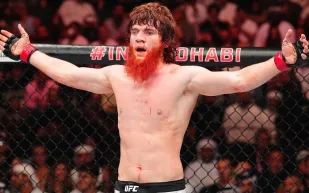 إصابة مقلقة لشارابوتدين محمدوف بعد نزال UFC.. كسر في الأنف وجراحة مرتقبة