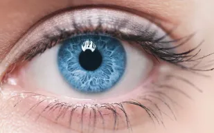 علامة في العين قد تشير إلى ارتفاع الكوليسترول دون أعراض