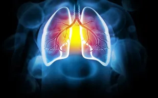 اكتشاف علمي يربط بين ألزهايمر وسرطان الرئة