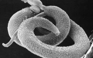 اكتشاف صادم: كيف يخدع طفيلي البلهارسيا الألم والمناعة ويتسبب في أمراض خطيرة