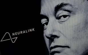 إيلون ماسك يحقق إنجازًا طبيًا بزرع أول شريحة دماغية لاسلكية
