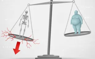 هل النحافة المفرطة أخطر على الصحة من زيادة الوزن؟ دراسة جديدة تثير الجدل