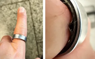 شكاوى متزايدة من بطارية خاتم سامسونغ غلاكسي الذكي