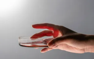 تحذير: الجلطات الدموية تهدد الموظفين في مكاتبهم