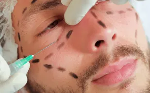 وسائل التواصل ترفع الضغوط.. وعمليات شد الوجه تتزايد بين الرجال والأربعينيين