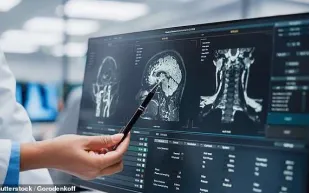 قلة النوم تهدد دماغك.. ودراسة توضح الرابط مع الخرف وألزهايمر