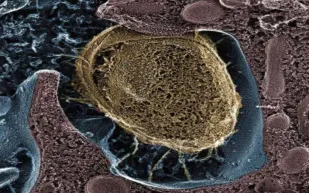 من نقص شرب الماء إلى ضعف النظافة.. أبرز أسباب التهابات المسالك البولية وطرق الوقاية