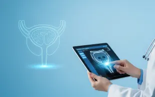 فحص بسيط قد ينقذ حياتك من سرطان البروستاتا